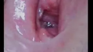 عشق شیرین, زن و شوهر, انجمن, چربی, زنان مستقر